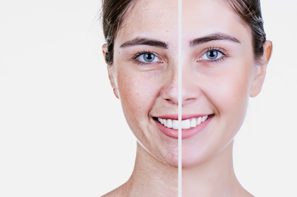 Anti-aging care