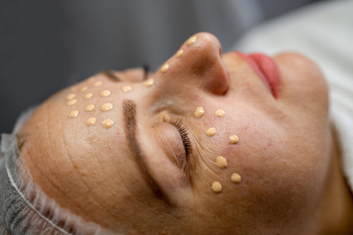 BB glow, facial beauty treatment,