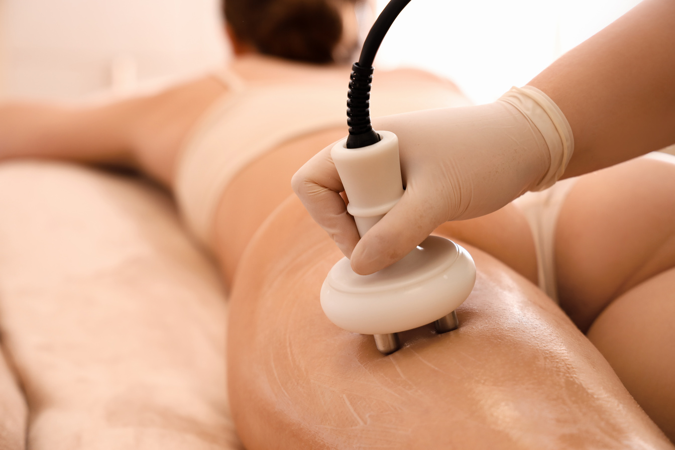 Young Woman Undergoing anti-Cellulite Treatment in Beauty Salon, Closeup