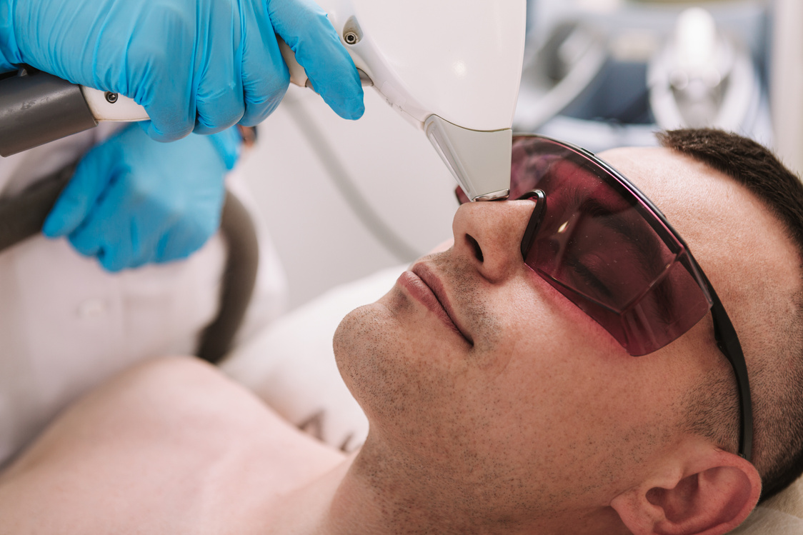 Cropped close up of a young man removing hair on his nose at beauty salon. Professional comsetologist using laser hair removal device on her male client