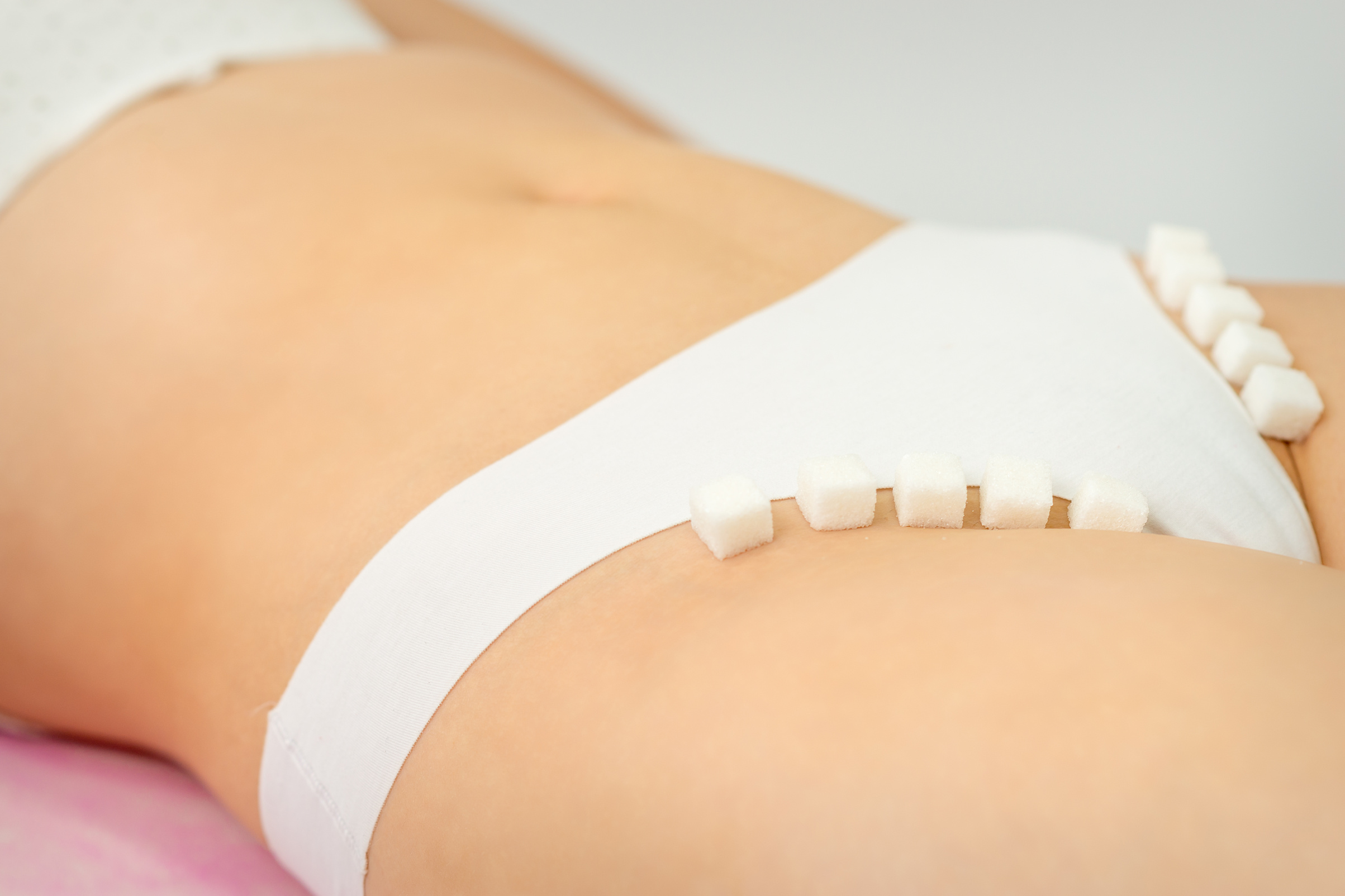 Sugar Cubes Lying in a Row on Female Bikini Zone, the Concept of Intimate Depilation, Problems of Intimate Hygiene.